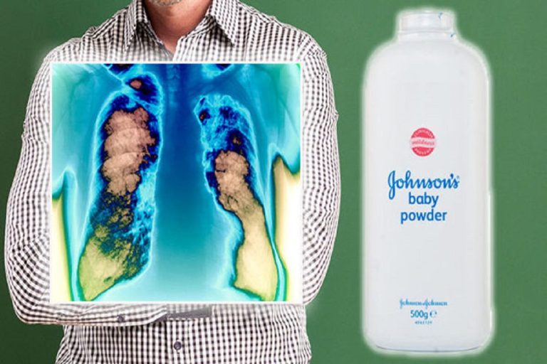 talcum baby powder lawsuit